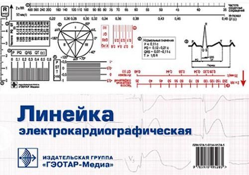 Линейка электрокардиографическая: ЭКГ-линейка для расшифровки электрокардиограммы, снятой со скорост