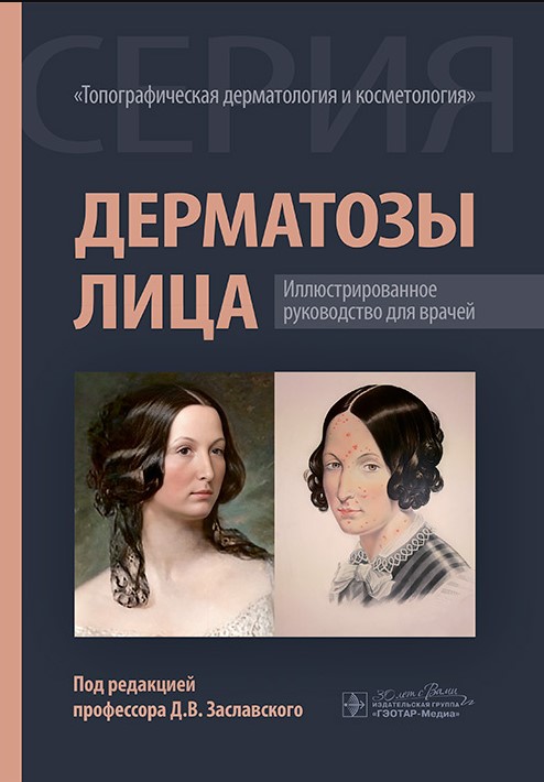 Дерматозы лица : иллюстрированное руководство для врачей / под ред. Д. В. Заславского. — Москва : ГЭ Дерматозы лица : иллюстрированное руководство для врачей / под ред. Д. В. Заславского. — Москва : ГЭ