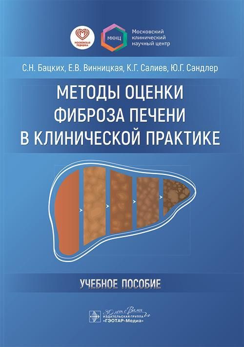 Методы оценки фиброза печени в клинической практике : учебное пособие / С. Н. Бацких, Е. В. Винницка