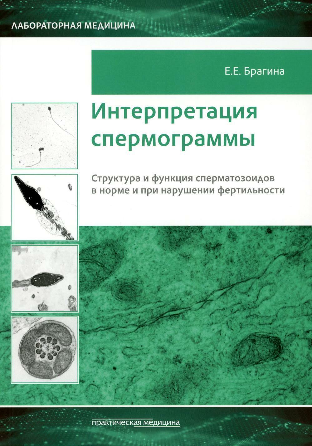 Интерпретация спермограммы. Структура и функция сперматозоидов в норме и при нарушении фертильности.