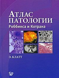 Атлас патологии Роббинса и Котрана