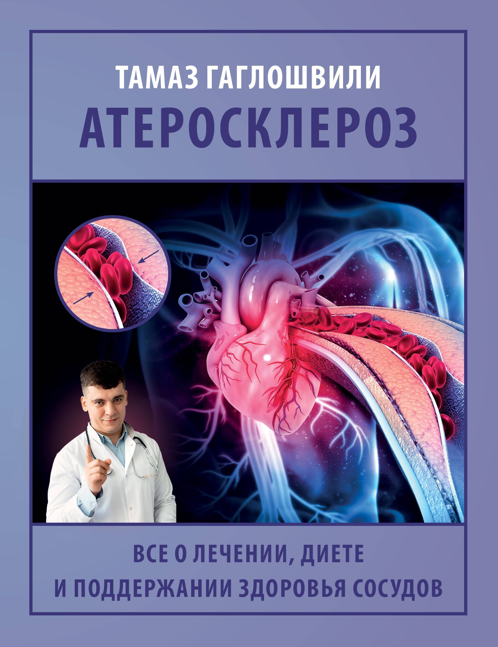 Атеросклероз. Все о лечении, диете и поддержании здоровья сосудов Атеросклероз. Все о лечении, диете и поддержании здоровья сосудов